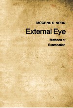 EXTERNAL EYE:METHODS OF EXAMINATION