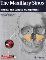 THE MAXILLARY SINUS MEDICAL AND SURGICAL MANAGEMENT