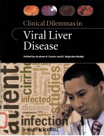 VIRAL LIVER DISEASE