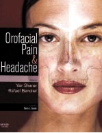 OROFACIAL PAIN AND HEADACHE