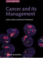 CANCER AND ITS MANAGEMENT