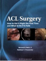 ACL SURGERY HOW TO GET IT RIGHT THE FIRST TIME AND WHAT TO DO IF IT FAILS