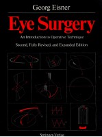 Eye Surgery