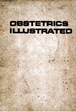 Obstetrics illustrated