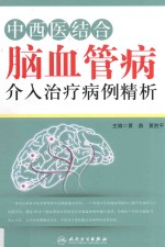 中西医结合脑血管病介入治疗病例精析