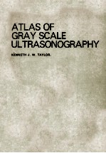 ATLAS OF GRAY SCALE ULTRASONSGRAPHY