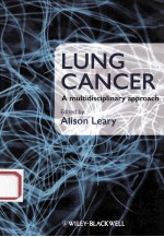 Lung Cancer:A Multidisciplinary Approach