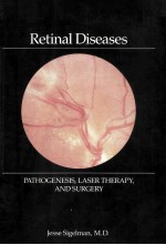 RETINAL DISEASES:PATHOGENESIS