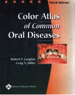 COLOR ATLAS OF COMMON ORAL DISEASES  THIRD EDITION