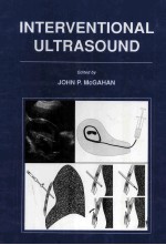 INTERVENTIONAL YLTRASOUND