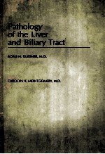 Pathology of the liver and biliary tract