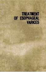 TREATMENT OF ESOPHAGEAL VARICES