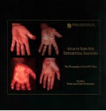 ATLAS OF SAME-SITE DIFFERENTIAL DIAGNOSES  VOLUME 1:HANDS AND UPPER EXTREMITIES